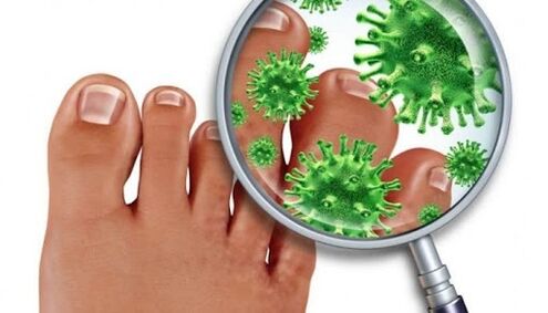 Гъбички за нокти