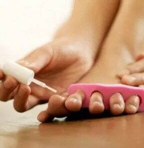 Прилагане на терапевтичен лак