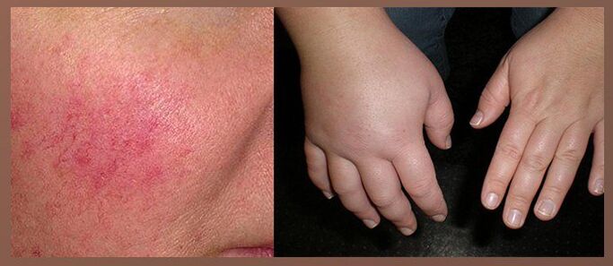 Странични ефекти на капки